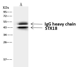 STX18 / Syntaxin 18 Antibody - STX18 was immunoprecipitated using: Lane A: 0.5 mg 293T Whole Cell Lysate. 4 uL anti-STX18 rabbit polyclonal antibody and 60 ug of Immunomagnetic beads Protein A/G. Primary antibody: Anti-STX18 rabbit polyclonal antibody, at 1:100 dilution. Secondary antibody: Goat Anti-Rabbit IgG (H+L)/HRP at 1/10000 dilution. Developed using the ECL technique. Performed under reducing conditions. Predicted band size: 39 kDa. Observed band size: 43 kDa.
