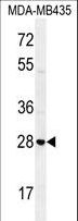 STX19 / Syntaxin 19 Antibody - STX19 Antibody western blot of MDA-MB435 cell line lysates (35 ug/lane). The STX19 antibody detected the STX19 protein (arrow).