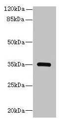 STX19 / Syntaxin 19 Antibody - Western blot All lanes: STX19 antibody at 2µg/ml + K562 whole cell lysate Secondary Goat polyclonal to rabbit IgG at 1/10000 dilution Predicted band size: 34 kDa Observed band size: 34 kDa