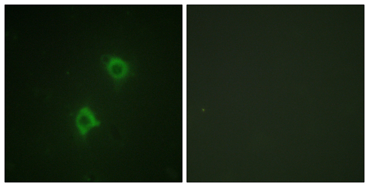 STX1A / Syntaxin 1A Antibody - Immunofluorescence analysis of NIH/3T3 cells, using Syntaxin 1A Antibody. The picture on the right is blocked with the synthesized peptide.