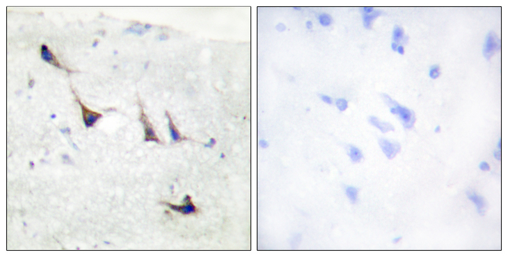 STX1A / Syntaxin 1A Antibody - Immunohistochemistry analysis of paraffin-embedded human brain tissue, using Syntaxin 1A Antibody. The picture on the right is blocked with the synthesized peptide.