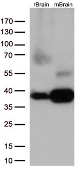 STX1A / Syntaxin 1A Antibody - Western blot analysis of extracts. (35ug) from 2 different tissue lysates by using anti-STX1A monoclonal antibody. (1:500)