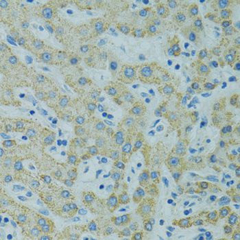 STX1A / Syntaxin 1A Antibody - Immunohistochemistry of paraffin-embedded human liver using STX1A antibody at dilution of 1:100 (40x lens).