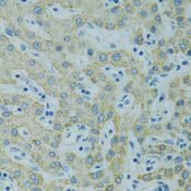 STX1A / Syntaxin 1A Antibody - Immunohistochemistry of paraffin-embedded human liver using STX1A antibody at dilution of 1:100 (40x lens).