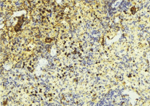 STX1A / Syntaxin 1A Antibody - 1:100 staining mouse liver tissue by IHC-P. The sample was formaldehyde fixed and a heat mediated antigen retrieval step in citrate buffer was performed. The sample was then blocked and incubated with the antibody for 1.5 hours at 22°C. An HRP conjugated goat anti-rabbit antibody was used as the secondary.