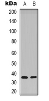 STX1A / Syntaxin 1A Antibody - Western blot analysis of Syntaxin 1A (pS14) expression in HeLa (A); mouse brain (B) whole cell lysates.