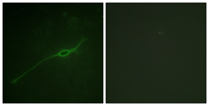 STX1A / Syntaxin 1A Antibody - Immunofluorescence analysis of NIH/3T3 cells, using Syntaxin 1A (Phospho-Ser14) Antibody. The picture on the right is blocked with the phospho peptide.