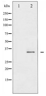 STX1A / Syntaxin 1A Antibody - Western blot of Syntaxin 1A phosphorylation expression in Mouse brain tissue lysates,The lane on the left is treated with the antigen-specific peptide.