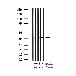 STX1A / Syntaxin 1A Antibody - Western blot analysis of Phospho-Syntaxin 1A (Ser14) expression in various lysates