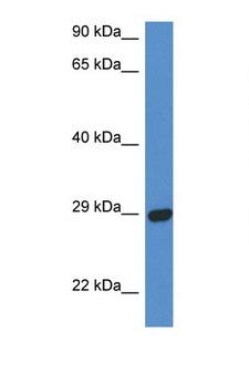 STX2 / Syntaxin 2 Antibody - STX2 / Syntaxin 2 antibody Western blot of Fetal Heart lysate. Antibody concentration 1 ug/ml.  This image was taken for the unconjugated form of this product. Other forms have not been tested.