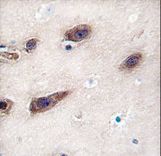 STX3 / Syntaxin 3 Antibody - Formalin-fixed and paraffin-embedded human brain tissue reacted with STX3 antibody , which was peroxidase-conjugated to the secondary antibody, followed by DAB staining. This data demonstrates the use of this antibody for immunohistochemistry; clinical relevance has not been evaluated.
