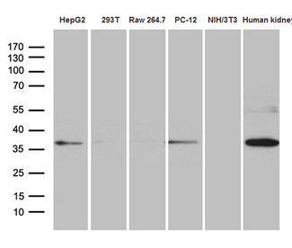 STX3 / Syntaxin 3 Antibody - Western blot analysis of extracts. (35ug) from 5 different cell lines and human kidney tissue lysate by using anti-STX3 monoclonal antibody. (1:500)