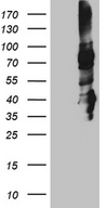 STX3 / Syntaxin 3 Antibody - HEK293T cells were transfected with the pCMV6-ENTRY control. (Left lane) or pCMV6-ENTRY STX3. (Right lane) cDNA for 48 hrs and lysed. Equivalent amounts of cell lysates. (5 ug per lane) were separated by SDS-PAGE and immunoblotted with anti-STX3. (1:2000)