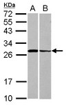 STX3 / Syntaxin 3 Antibody - Sample (30 ug of whole cell lysate) A: HeLa B: HCT116 12% SDS PAGE STX3 / Syntaxin 3 antibody diluted at 1:1000
