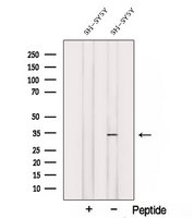 STX3 / Syntaxin 3 Antibody - Western blot analysis of extracts of SH-SY5Y cells using Syntaxin3 antibody. The lane on the left was treated with blocking peptide.