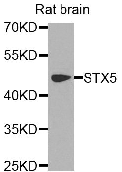 STX5 / Syntaxin 5 Antibody - Western blot analysis of extracts of rat brain cells.