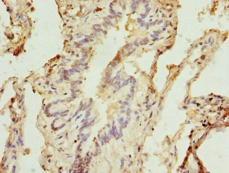 STX5 / Syntaxin 5 Antibody - Immunohistochemistry of paraffin-embedded human lung tissue tissue at dilution 1:100