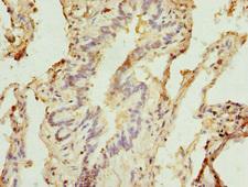 STX5 / Syntaxin 5 Antibody - Immunohistochemistry of paraffin-embedded human lung tissue tissue at dilution 1:100