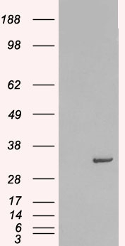 STX6 / Syntaxin 6 Antibody - HEK293 overexpressing Human STX6 (RC202951) and probed with (mock transfection in first lane).