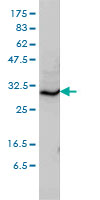 STX6 / Syntaxin 6 Antibody - STX6 monoclonal antibody (M01), clone 1G2 Western blot of STX6 expression in HL-60.