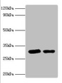 STX6 / Syntaxin 6 Antibody - Western blot All lanes: Syntaxin-6 antibody at 2µg/ml Lane 1: Mouse brain tissue Lane 2: 293T whole cell lysaye Secondary Goat polyclonal to rabbit IgG at 1/10000 dilution Predicted band size: 29 kDa Observed band size: 29 kDa