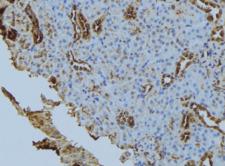 STX6 / Syntaxin 6 Antibody - 1:100 staining mouse kidney tissue by IHC-P. The sample was formaldehyde fixed and a heat mediated antigen retrieval step in citrate buffer was performed. The sample was then blocked and incubated with the antibody for 1.5 hours at 22°C. An HRP conjugated goat anti-rabbit antibody was used as the secondary.