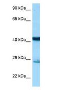 STX7 / Syntaxin 7 Antibody - STX7 / Syntaxin 7 antibody Western Blot of Mouse Liver.  This image was taken for the unconjugated form of this product. Other forms have not been tested.