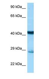 STX7 / Syntaxin 7 Antibody - STX7 / Syntaxin 7 antibody Western Blot of Mouse Liver.  This image was taken for the unconjugated form of this product. Other forms have not been tested.