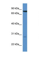 STX7 / Syntaxin 7 Antibody - STX7 / Syntaxin 7 antibody Western blot of 721_B Cell lysate. Antibody concentration 1 ug/ml.  This image was taken for the unconjugated form of this product. Other forms have not been tested.