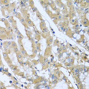 STX7 / Syntaxin 7 Antibody - Immunohistochemistry of paraffin-embedded human stomach tissue.