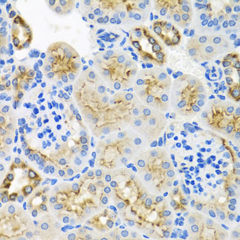 STX7 / Syntaxin 7 Antibody - Immunohistochemistry of paraffin-embedded mouse kidney tissue.
