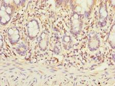 STX7 / Syntaxin 7 Antibody - Immunohistochemistry of paraffin-embedded human small intestine at dilution 1:100