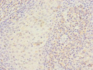 STX7 / Syntaxin 7 Antibody - Immunohistochemistry of paraffin-embedded human tonsil tissue at dilution 1:100