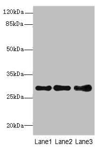 STX7 / Syntaxin 7 Antibody - Western blot All Lanes: STX7antibody at 1.39ug/ml Lane 1 : Mouse spleen tissue Lane 2 : Hela whole cell lysate Lane 3 : HepG-2 whole cell lysate Secondary Goat polyclonal to Rabbit IgG at 1/10000 dilution Predicted band size: 30,28 kDa Observed band size: 30 kDa