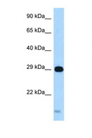 STX8 / Syntaxin 8 Antibody - STX8 / Syntaxin 8 antibody Western blot of Fetal Heart lysate. Antibody concentration 1 ug/ml.  This image was taken for the unconjugated form of this product. Other forms have not been tested.