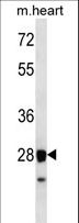 STX8 / Syntaxin 8 Antibody - STX8 Antibody western blot of mouse heart tissue lysates (35 ug/lane). The STX8 antibody detected the STX8 protein (arrow).