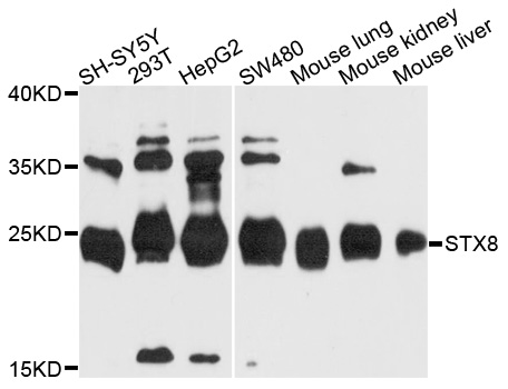 STX8 / Syntaxin 8 Antibody - Western blot analysis of extracts of various cell lines, using STX8 antibody at 1:1000 dilution. The secondary antibody used was an HRP Goat Anti-Rabbit IgG (H+L) at 1:10000 dilution. Lysates were loaded 25ug per lane and 3% nonfat dry milk in TBST was used for blocking. An ECL Kit was used for detection and the exposure time was 90s.
