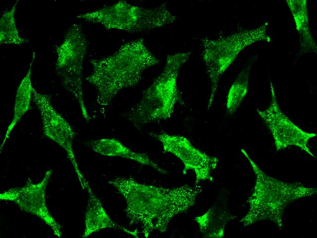 STX8 / Syntaxin 8 Antibody - Immunofluorescence staining of STX8 in Hela cells. Cells were fixed with 4% PFA, permeabilzed with 0.3% Triton X-100 in PBS, blocked with 10% serum, and incubated with rabbit anti-Human STX8 polyclonal antibody (dilution ratio 1:1000) at 4°C overnight. Then cells were stained with the Alexa Fluor 488-conjugated Goat Anti-rabbit IgG secondary antibody (green). Positive staining was localized to cytoplasm.
