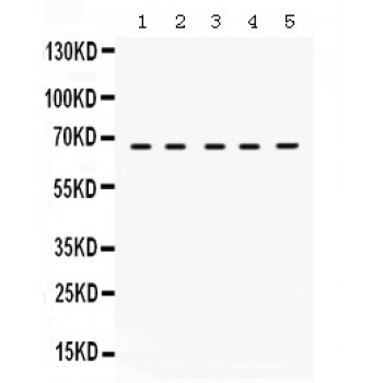 STXBP1 / MUNC18-1 Antibody - Munc18-1 antibody Western blot. All lanes: Anti Munc18-1 at 0.5 ug/ml. Lane 1: Rat Brain Tissue Lysate at 50 ug. Lane 2: Mouse Brain Tissue Lysate at 50 ug. Lane 3: PANC Whole Cell Lysate at 40 ug. Lane 4: HEPG2 Whole Cell Lysate at 40 ug. Lane 5: HELA Whole Cell Lysate at 40 ug. Predicted band size: 67 kD. Observed band size: 67 kD.