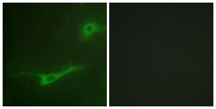 STXBP1 / MUNC18-1 Antibody - Peptide - + Immunofluorescence analysis of NIH/3T3 cells, using MUNC-18a antibody.