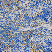 STXBP1 / MUNC18-1 Antibody - Immunohistochemistry of paraffin-embedded rat spleen tissue.