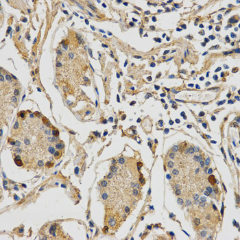 STXBP1 / MUNC18-1 Antibody - Immunohistochemistry of paraffin-embedded human stomach tissue.