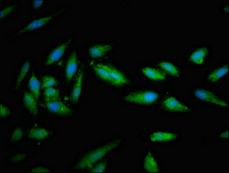 STXBP1 / MUNC18-1 Antibody - Immunofluorescent analysis of Hela cells at a dilution of 1:100 and Alexa Fluor 488-congugated AffiniPure Goat Anti-Rabbit IgG(H+L)