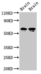 STXBP1 / MUNC18-1 Antibody - Positive Western Blot detected in Rat brain tissue, Mouse brain tissue. All lanes: STXBP1 antibody at 2 µg/ml Secondary Goat polyclonal to rabbit IgG at 1/50000 dilution. Predicted band size: 68, 69 KDa. Observed band size: 68, 69 KDa