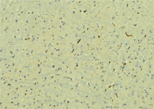 STXBP1 / MUNC18-1 Antibody - 1:100 staining mouse brain tissue by IHC-P. The sample was formaldehyde fixed and a heat mediated antigen retrieval step in citrate buffer was performed. The sample was then blocked and incubated with the antibody for 1.5 hours at 22°C. An HRP conjugated goat anti-rabbit antibody was used as the secondary.