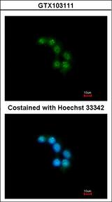 STXBP2 Antibody - Immunofluorescence of methanol-fixed HepG2 using STXBP2 antibody at 1:200 dilution.