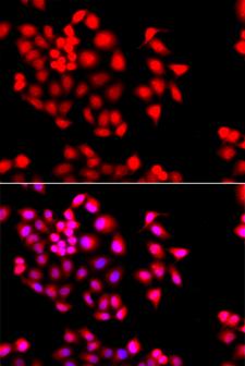STXBP2 Antibody - Immunofluorescence blot of A549 cell using STXBP2 antibody. Blue: DAPI for nuclear staining.