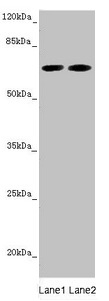 STXBP2 Antibody - Western blot All lanes: STXBP2 antibody at 5.88µg/ml Lane 1: Mouse brain tissue Lane 2: A549 whole cell lysate Secondary Goat polyclonal to rabbit IgG at 1/10000 dilution Predicted band size: 67, 68 kDa Observed band size: 67 kDa