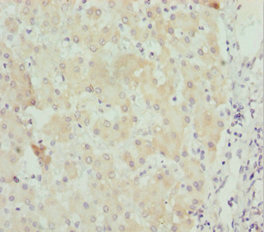 STXBP2 Antibody - Immunohistochemistry of paraffin-embedded human liver tissue at dilution 1:100