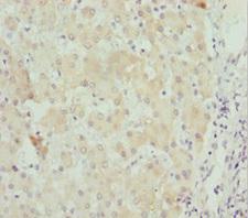 STXBP2 Antibody - Immunohistochemistry of paraffin-embedded human liver tissue at dilution 1:100